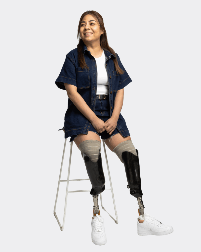 A woman using prosthetic legs is sitting on a chair and looking away from the camera and smiling.